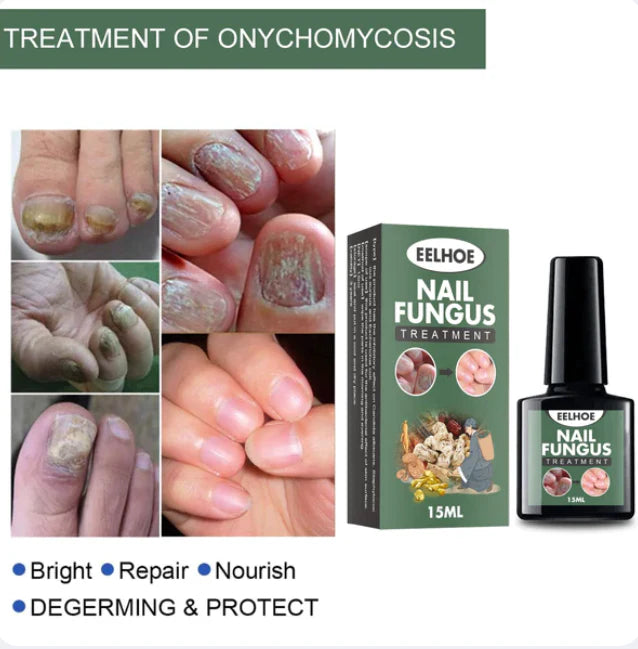 Ulje za gljivice i ispucale nokte NAIL FUNGUS