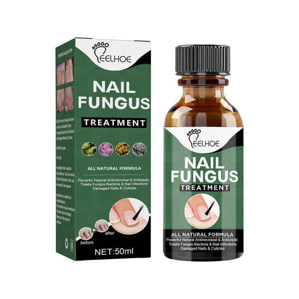 Ulje za gljivice i ispucale nokte NAIL FUNGUS