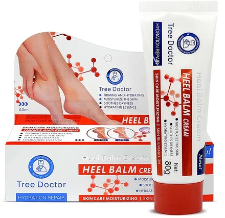 Krema za ispucale pete