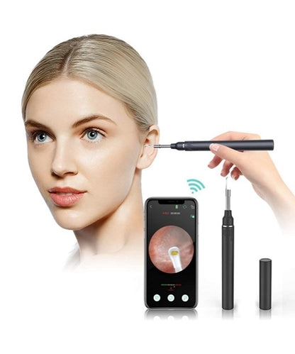 Otoskop kamera za pregled čišćenje uha - SA KAMEROM